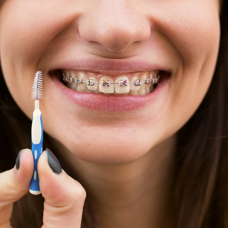S.I.Y. Dental — це сучасна цифрова стоматологія  в&nbsp;Києві. Ми надаємо повний спектр стоматологічних послуг, включаючи терапевтичне та хірургічне лікування, ортодонтію й імплантацію зубів